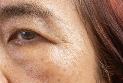 Glow Beyond Limits Your Go-To Guide for Banishing Dark Spots with Koji White Dark Spot Serum