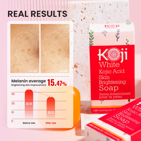 Pure 5% Kojic Acid Skin Brightening Soap (2 Bars)