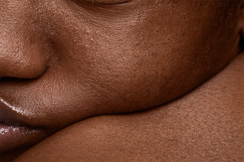 Kojic Acid + Tranexamic Acid: The Dream Duo for Fading Dark Spots