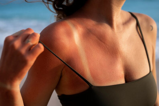 The Sun’s Impact On Your Skin
