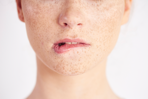 5 Best Kojic Acid Soaps for Hyperpigmentation (2026 Guide)