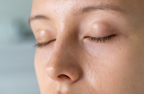 5 Common Causes of Dull Skin (and What You Can Do About It)