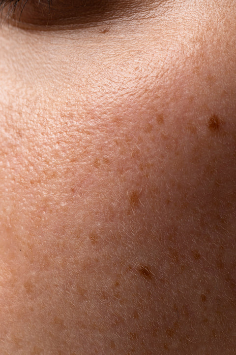 5 Best Turmeric Soaps for Dark Spots (2026)