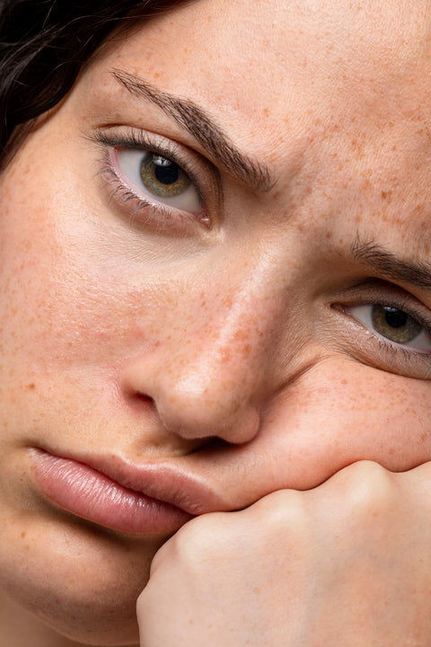 3 Common Mistakes People with Melanin Skin Make When Trying to Fade Dark Spots