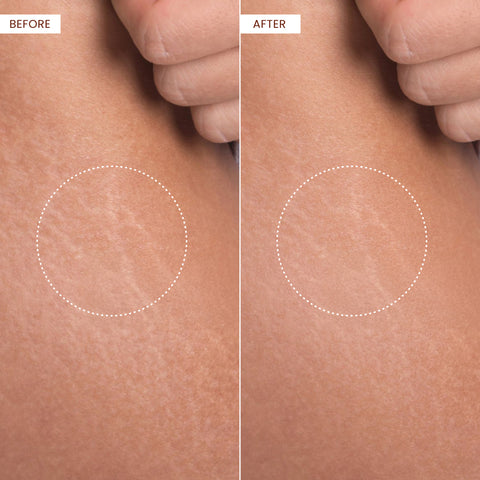 Koji White Kojic Acid Bump Eraser Body Scrub Soap (2 Bars) - Koji White