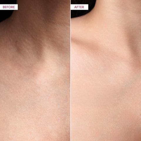 Kojic Acid & Collagen Skin Brightening Body Lotion (2 Bottles) - Koji White