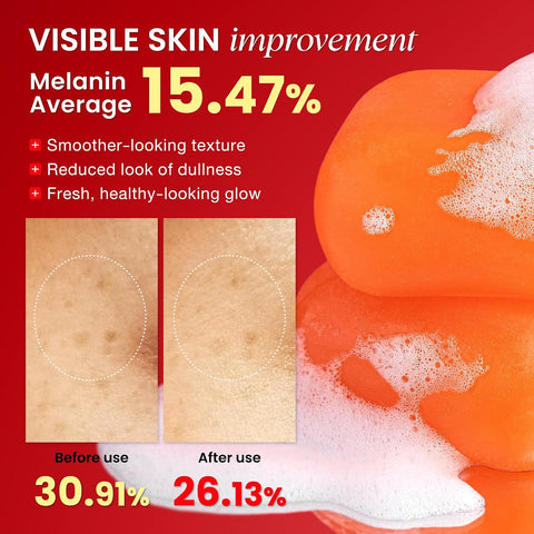 Pure Kojic Acid Skin Brightening Soap (2 Bars)