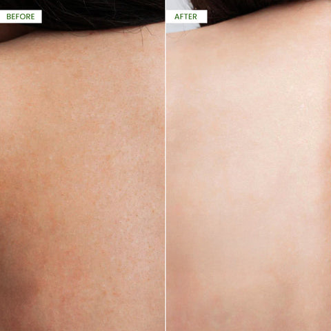 Kojic Acid & Papaya Skin Brightening Body Lotion (2 Bottles) - Koji White