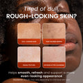 Two bars of Kojiwhite Kojic Acid and Papaya skin brightening soap with fresh papaya slices on the packaging.