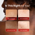 Koji White Kojic Acid Dark Spot Duo bundle with red lotion bottles, designed to reduce dark spots and brighten skin.