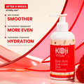 Koji White Kojic Acid Dark Spot Duo bundle featuring a red lotion bottle for brightening and skin tone evening.