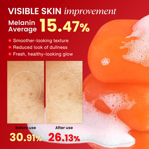 Koji White Pigment Face Correction Kit bundle with skincare products and tools for reducing pigmentation and evening skin tone.
